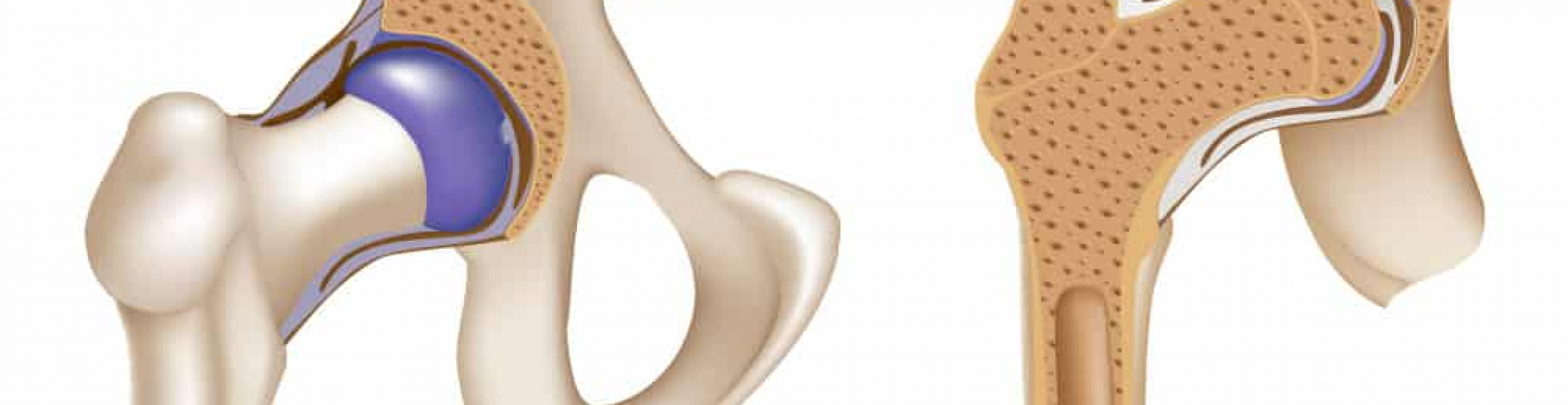 Why do Orthopaedic surgeons perform the anterior approach? Micheal Stening