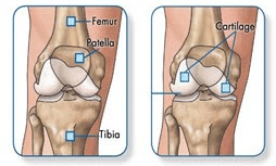 Knee conditions